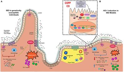 Heme Oxygenase-1 as a Modulator of Intestinal Inflammation Development and Progression